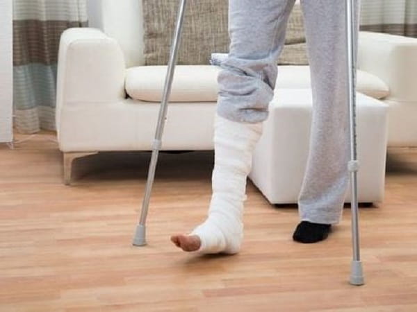 Nằm mơ thấy gãy chân có ý nghĩa gì, tốt hay xấu?
