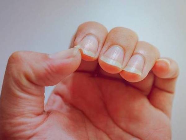 Nằm mơ thấy gãy móng tay là điềm gì, phúc hay họa?