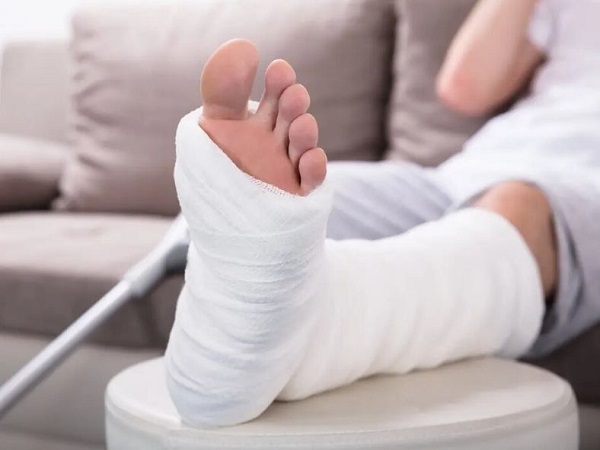 Nằm mơ thấy gãy chân là điềm tốt hay xấu?